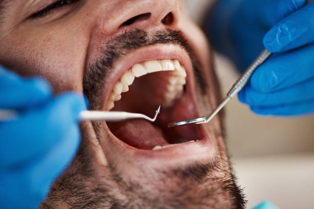 Best Broken or Chipped Tooth Repair in Park Hill, OK